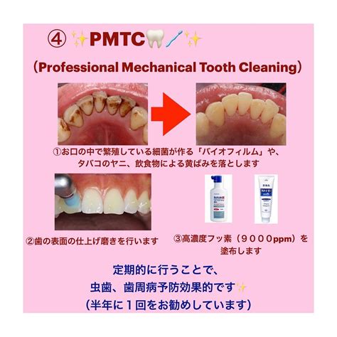 Pmtc.