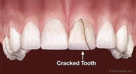 isitcracked