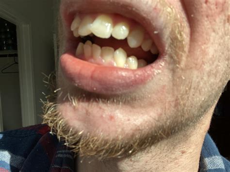 r/askdentists